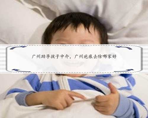 广州助孕孩子中介，广州疤痕去除哪家好